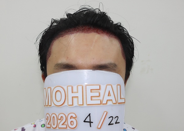 746b0731474782e1f6469d0ede31cd97_1782173051_8107.jpg 746b0731474782e1f6469d0ede31cd97_1782173051_8107.jpg