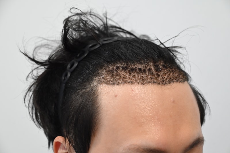 포토후기 이미지