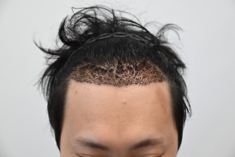 771120076db498b4bea11d7af9a386e3_1781947703_9937.jpg