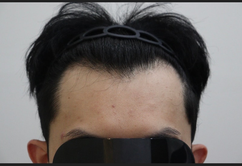 포토후기 이미지