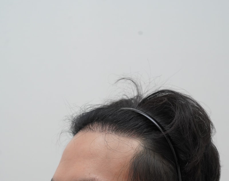 e06a60d9bb119a684a96aab892b2c67c_1781161387_5931.JPG