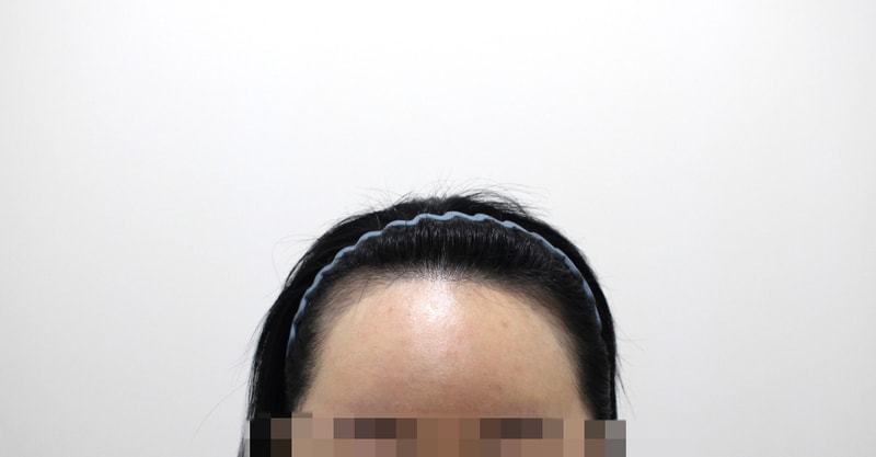 포토후기 이미지