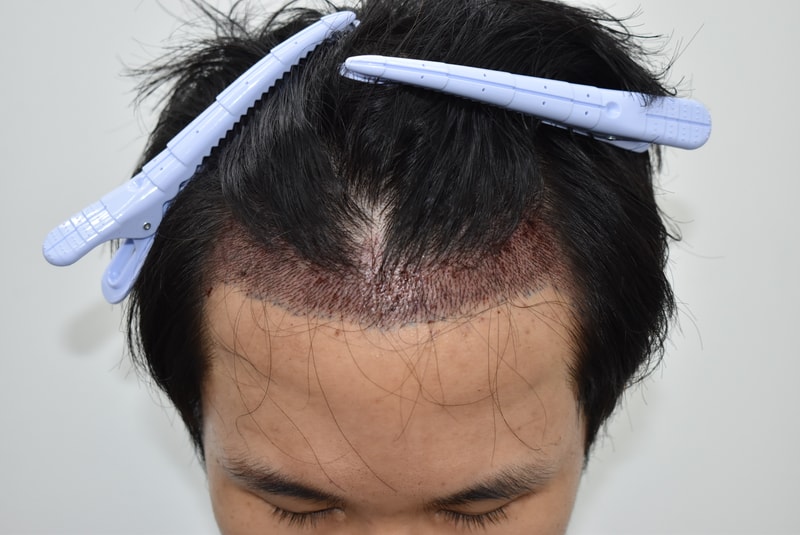 포토후기 이미지