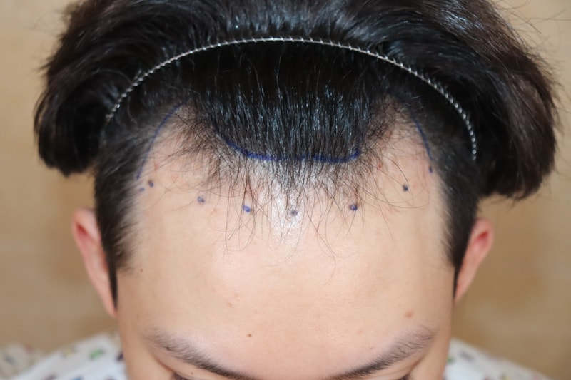 포토후기 이미지