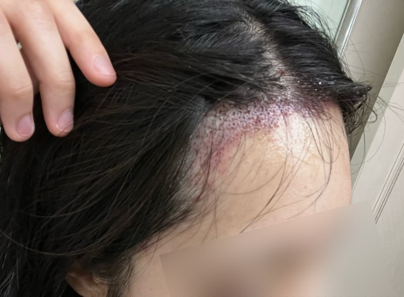 포토후기 이미지