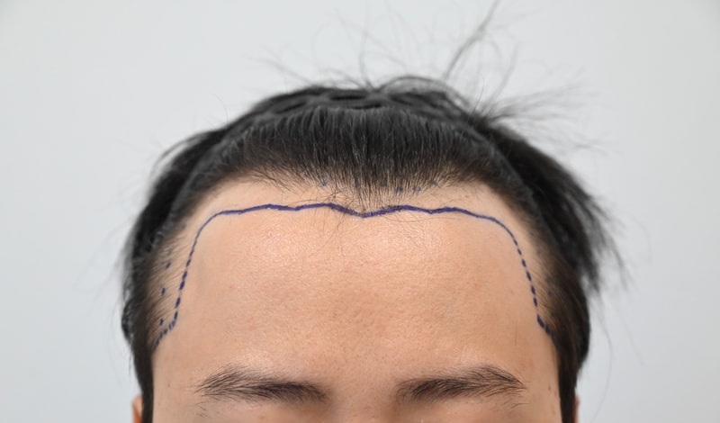 포토후기 이미지