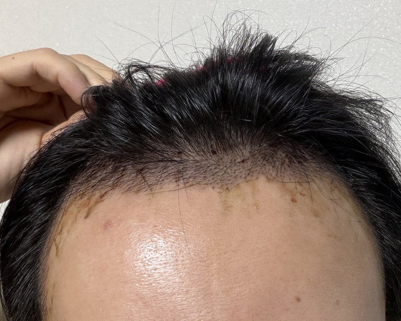 포토후기 이미지