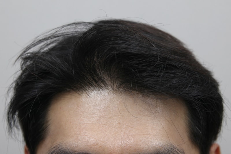 포토후기 이미지