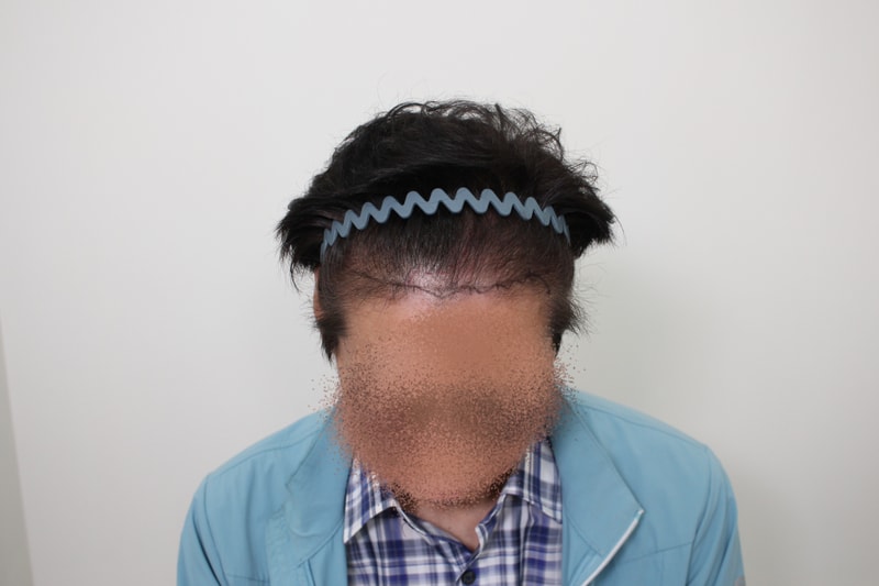 포토후기 이미지