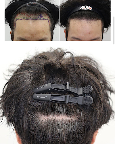 ca00ddb881cabd7729bc298d5f1b70a7_1784265060_48.png