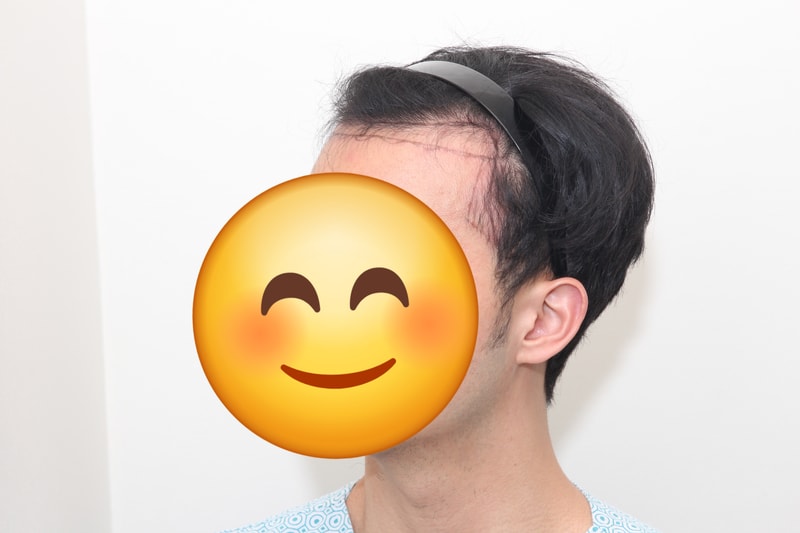 포토후기 이미지
