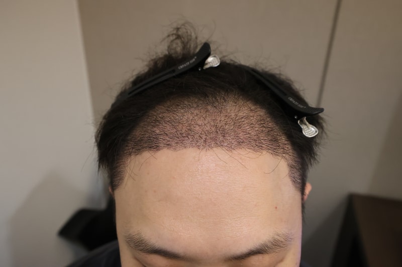 f55931671038312639f177d44b152f4c_1785402779_476.jpg f55931671038312639f177d44b152f4c_1785402779_476.jpg