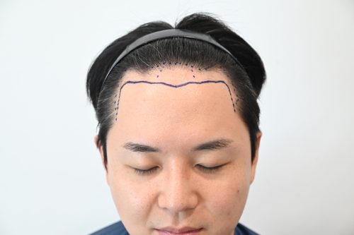 포토후기 이미지