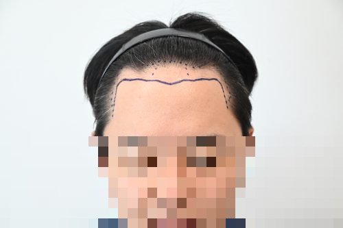 포토후기 이미지