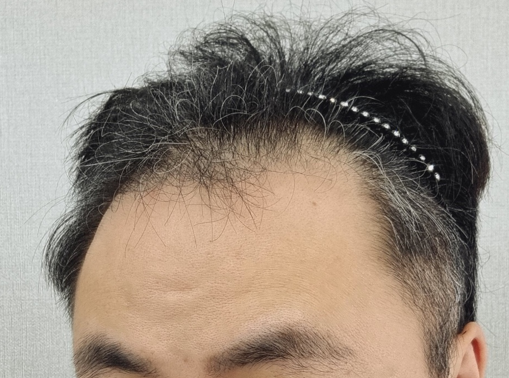 포토후기 이미지