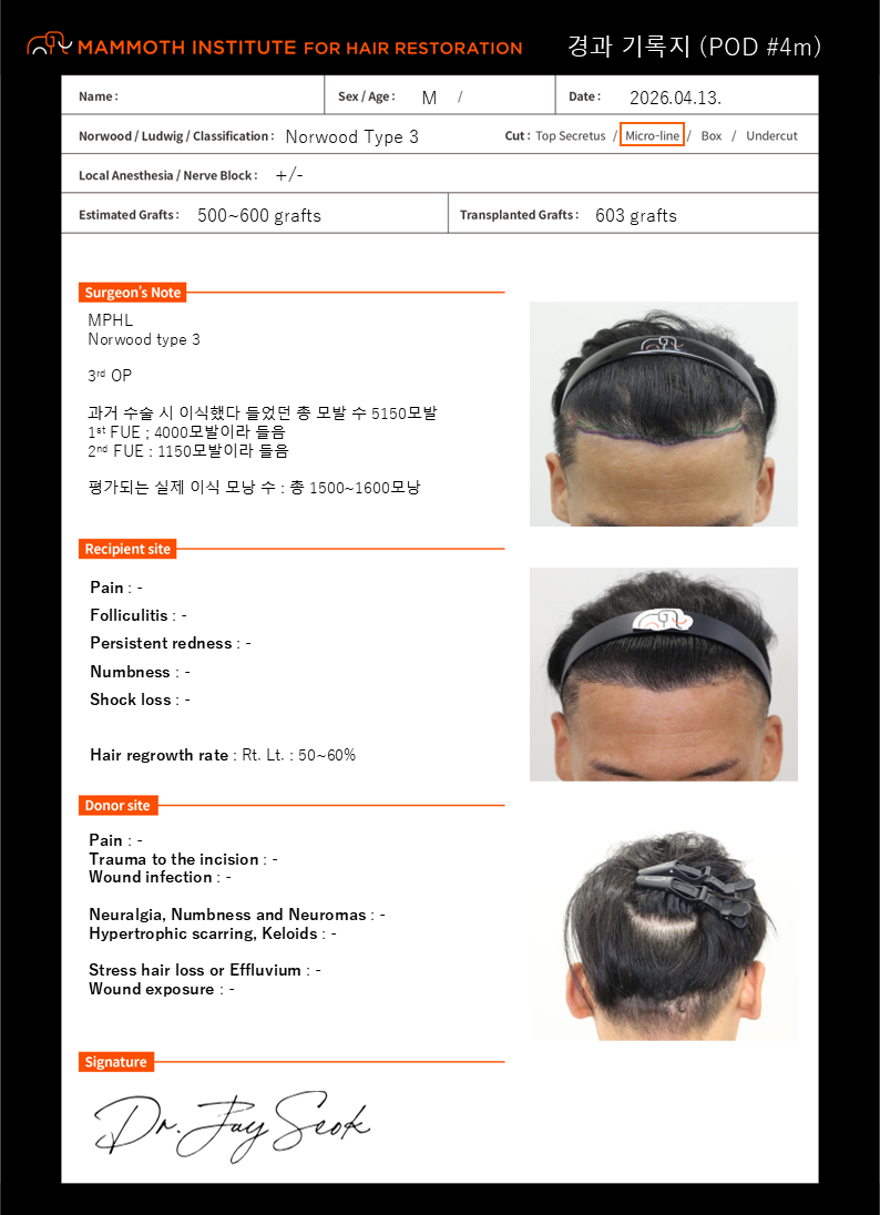 포토후기 이미지