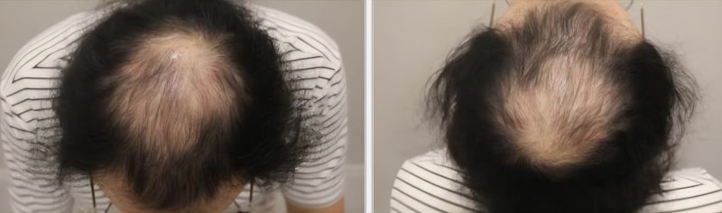 포토후기 이미지