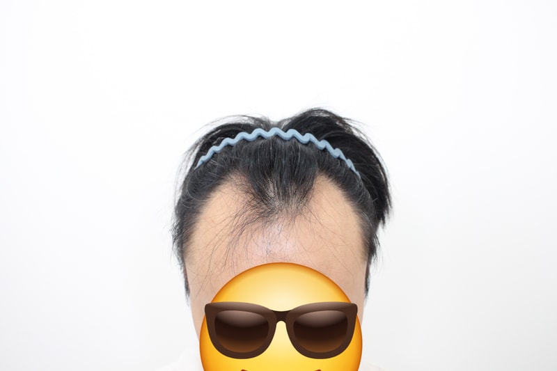 포토후기 이미지