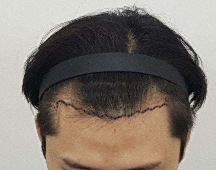 포토후기 이미지