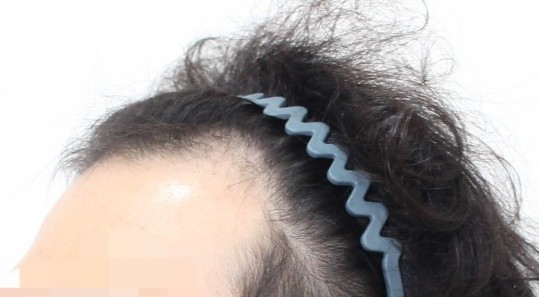 포토후기 이미지