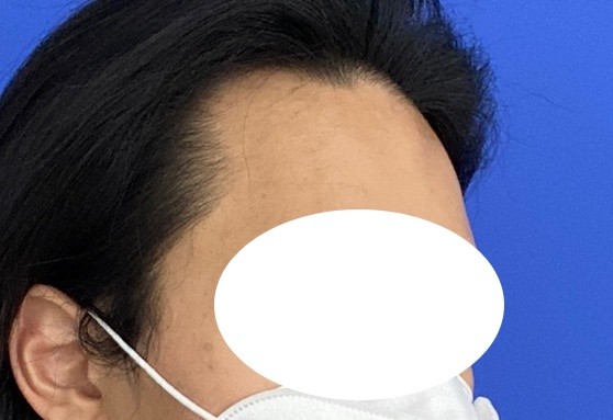 포토후기 이미지