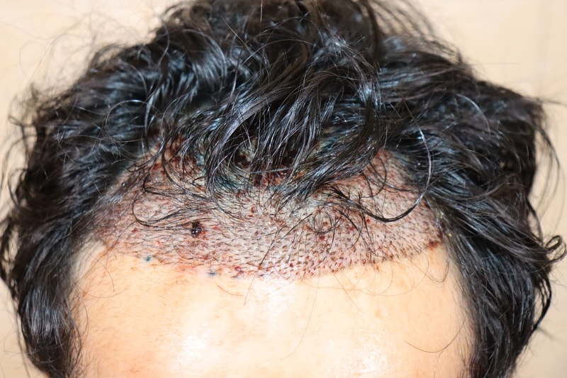 5b45ce4a8e34347ce7b7c6830da091ba_1792303999_901.jpg