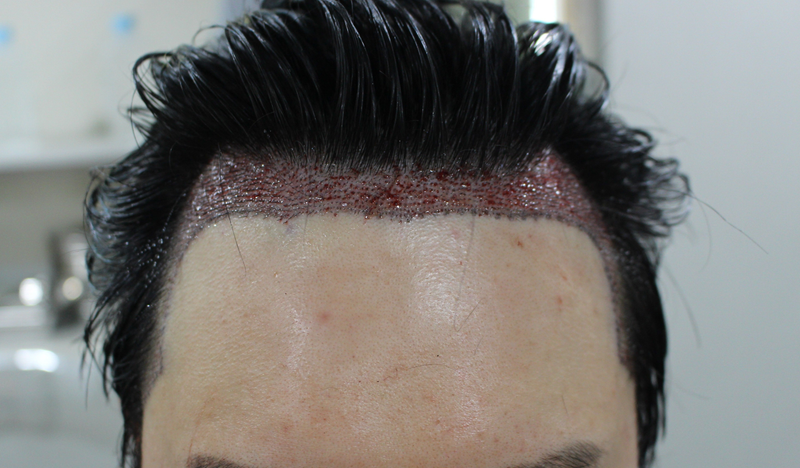 9cf45172c4d02df7414ad1e4ef1b6d1a_1791609432_0799.PNG