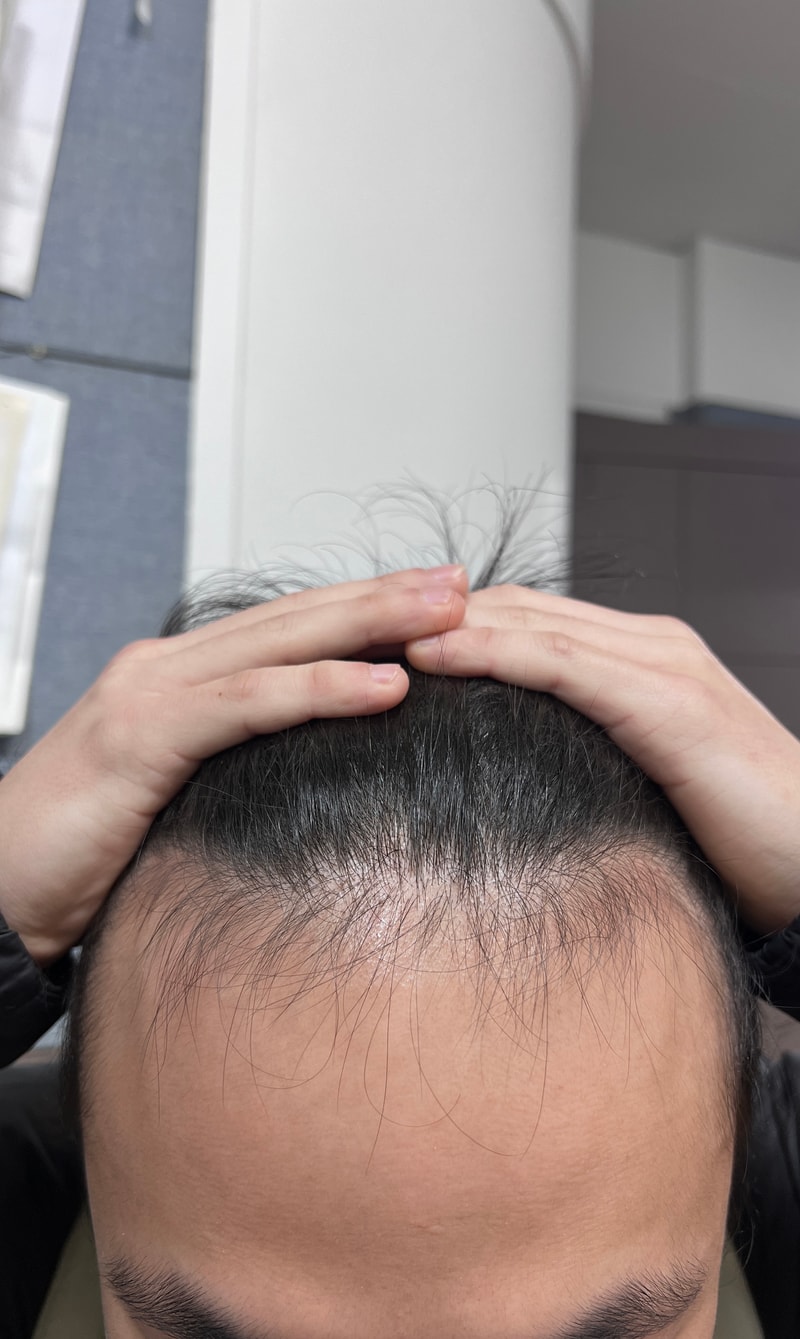 こんにちは 24歳の男性です