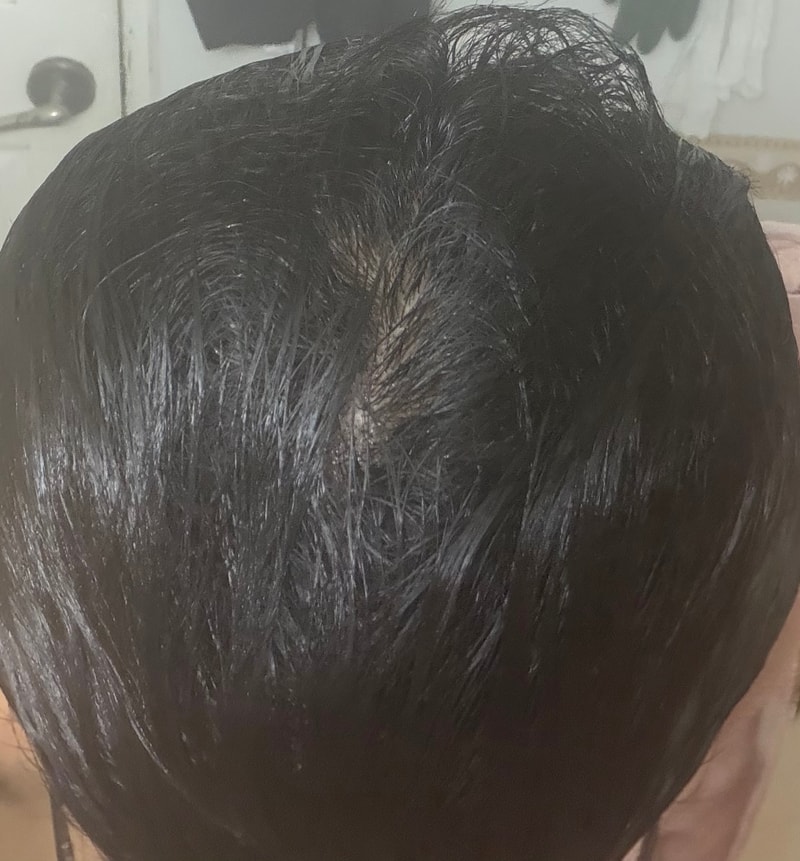 23です。薄毛見てください