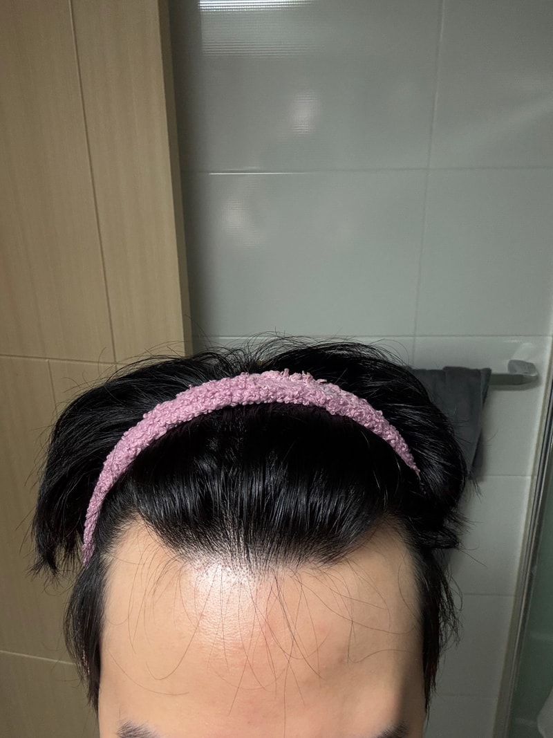 いや、これ脱毛なの？23歳