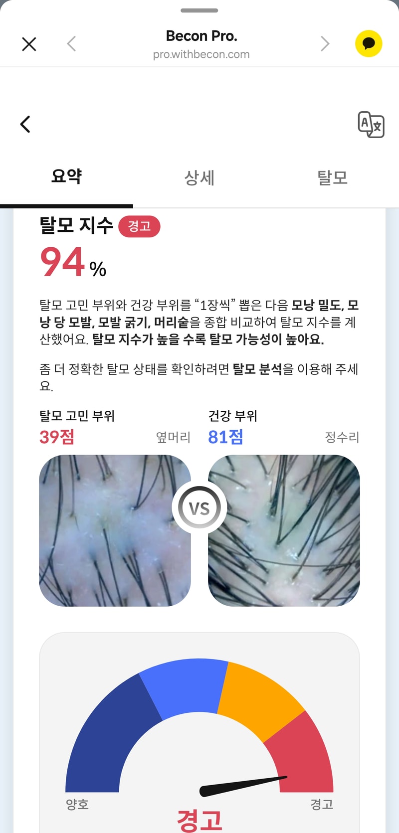 23歳、これ薄毛症？