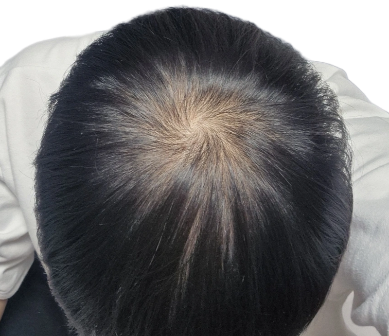 薄毛ですよね…？