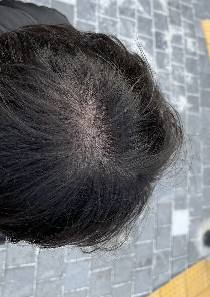 薬で復旧できるかな？