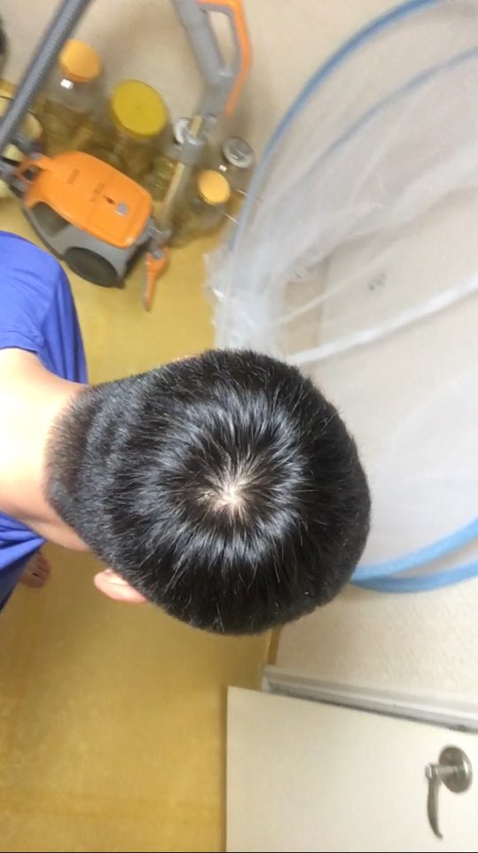 현광등 정수리4.jpg