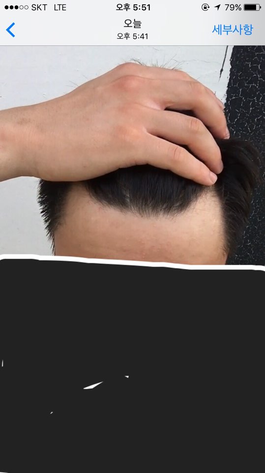 이마1.jpg