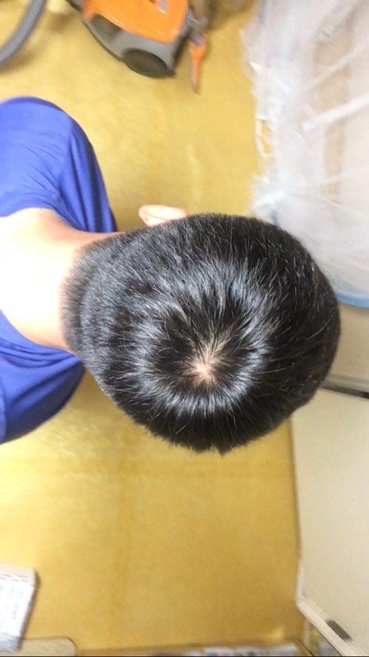 현광등 정수리 1.jpg