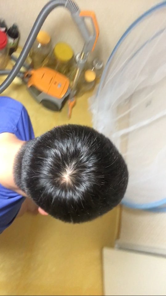 현광등 정수리 3.jpg