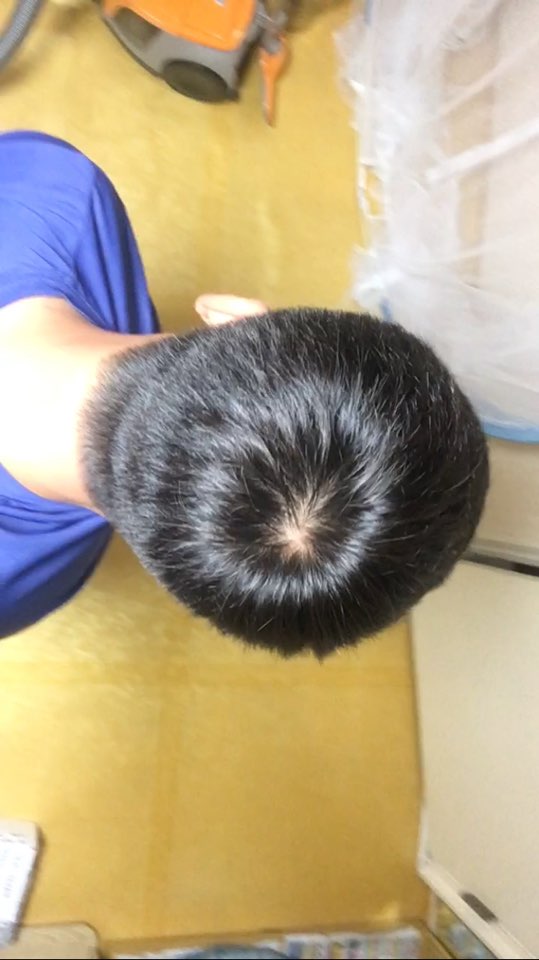 현광등 정수리 2.jpg