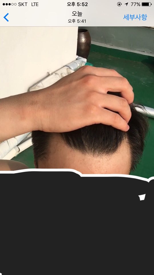 이마2.jpg