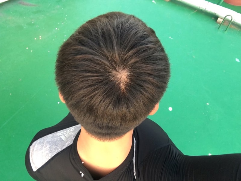 정수리1.jpg