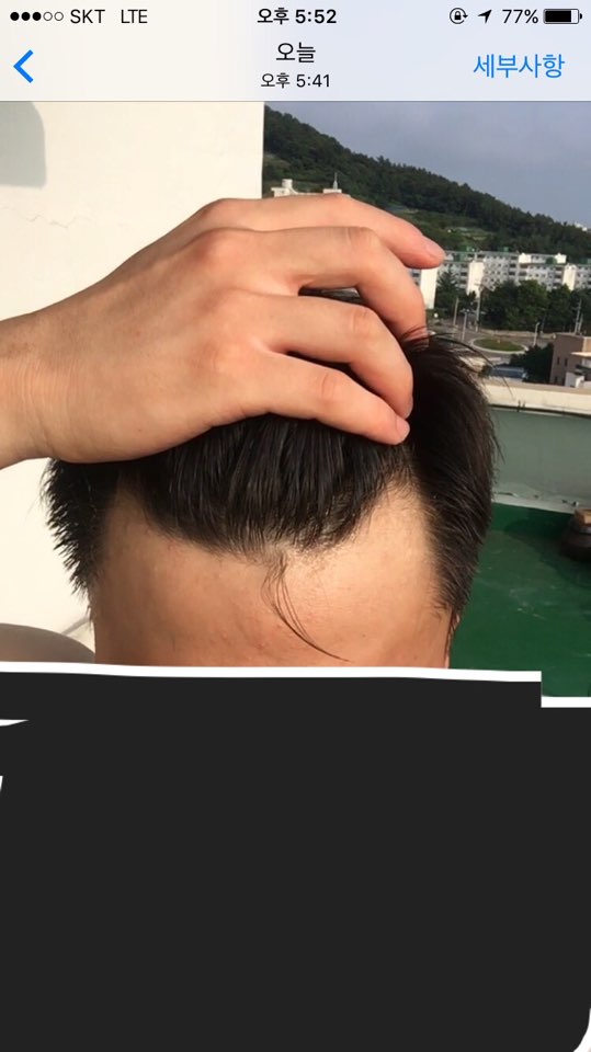 이마3.jpg