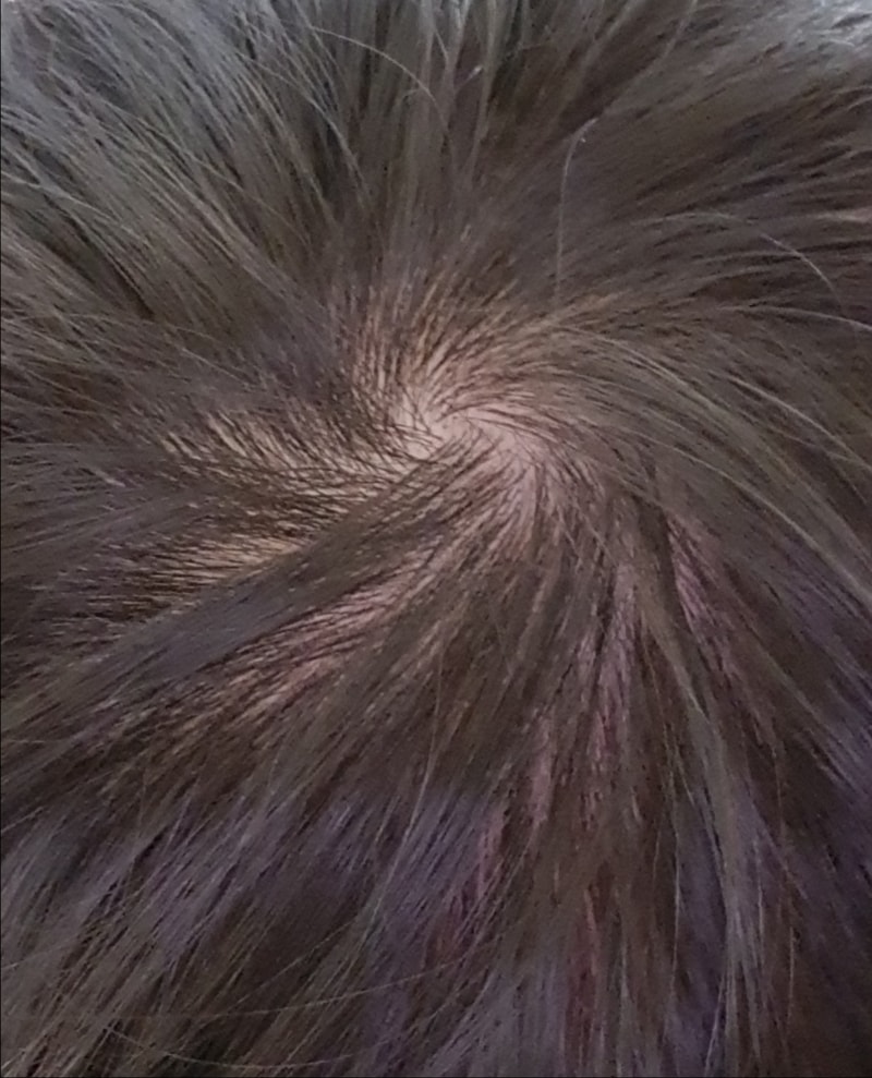 20180104_215747.jpg