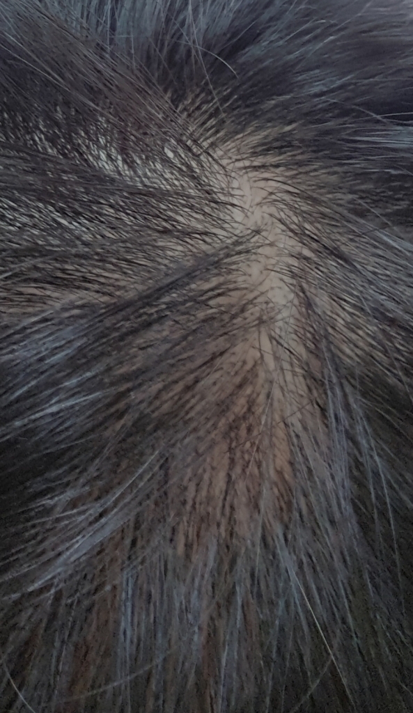20180104_215927.jpg
