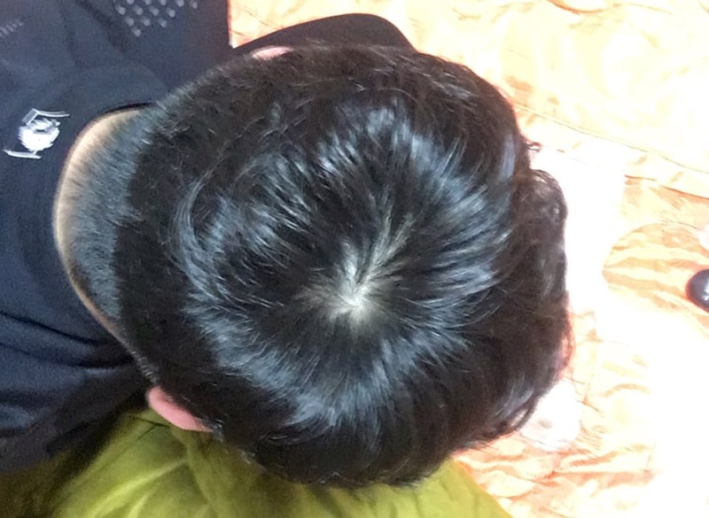 정수리5.jpg