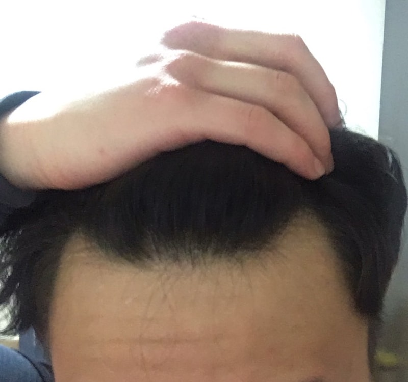 이마2.jpg