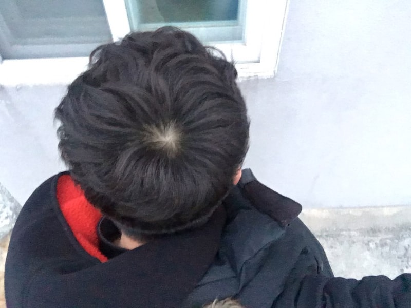 밖에서 정수리 4.jpg