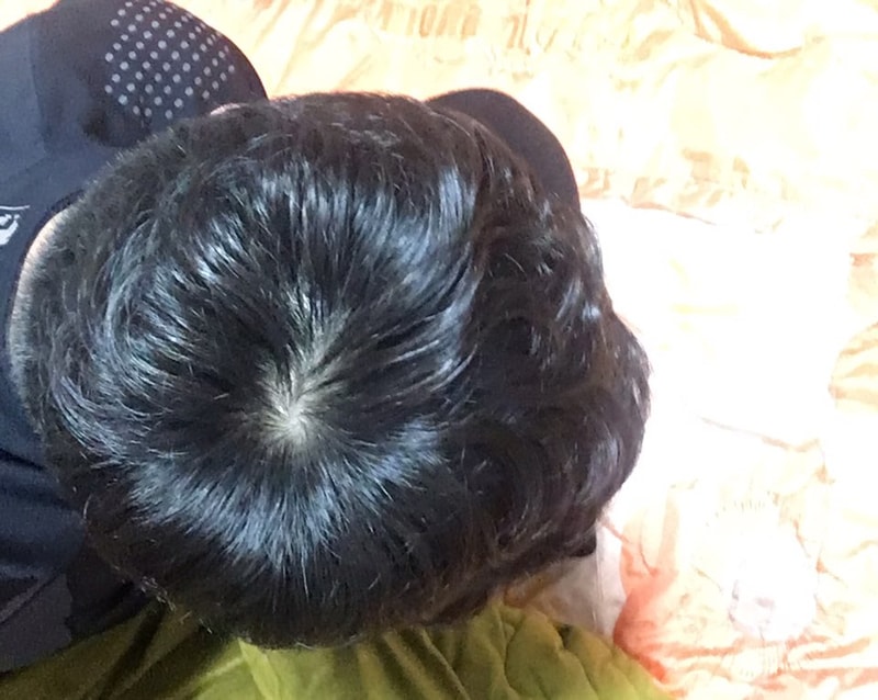 정수리4.jpg