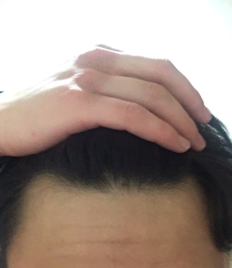 이마4.jpg