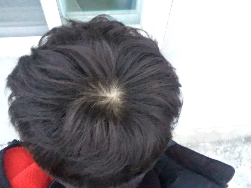 밖에서 정수리 3.jpg