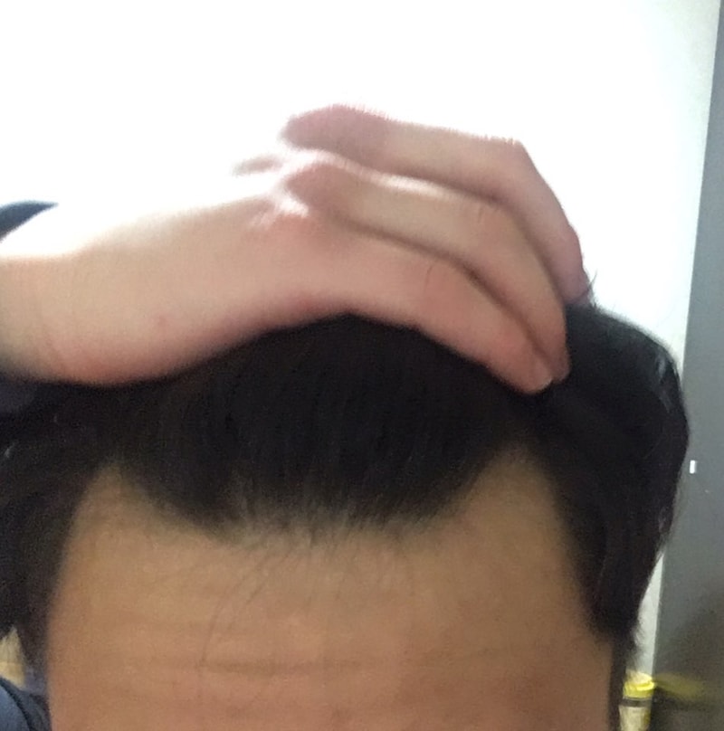 이마1.jpg